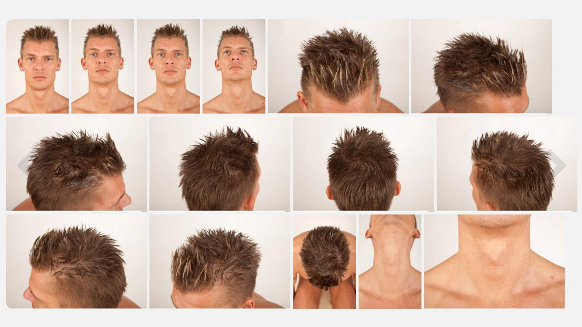 Alton High Res Skin Texture Photo Set by N/A