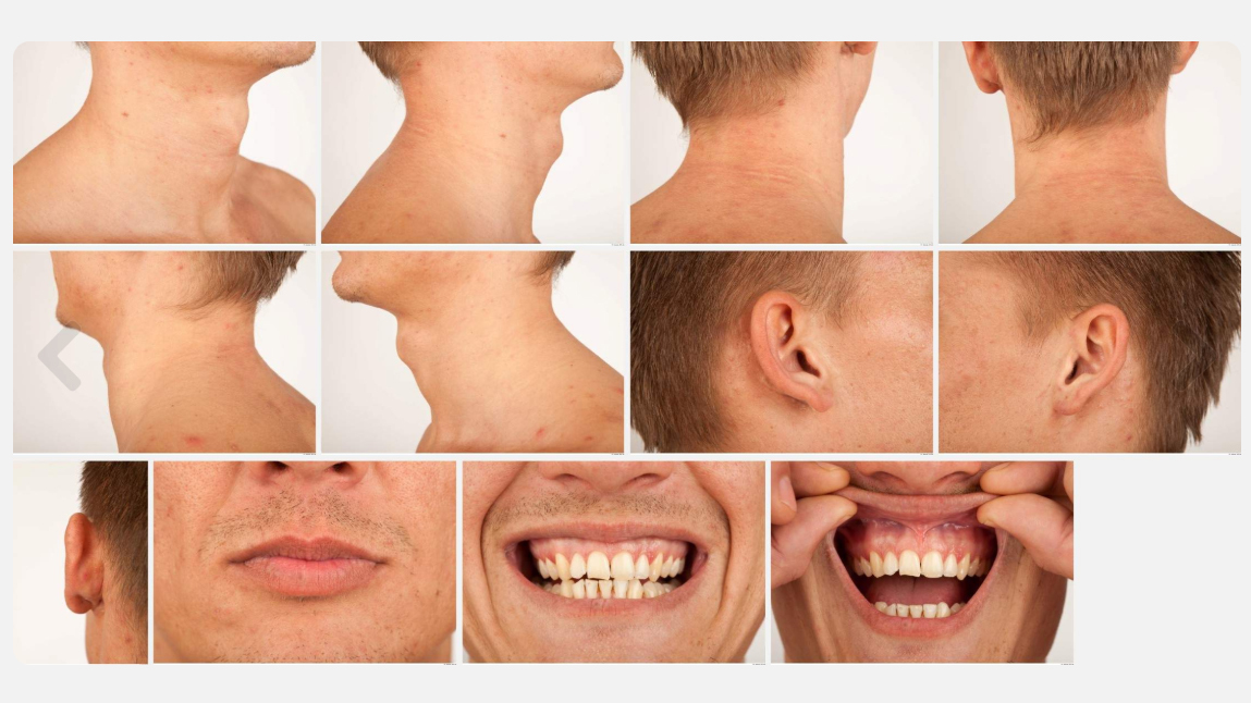 Alton High Res Skin Texture Photo Set by N/A