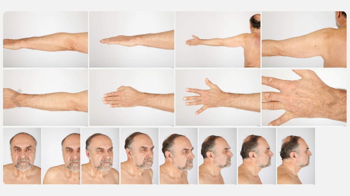 Alojz High Res Skin Texture Photo Set by N/A