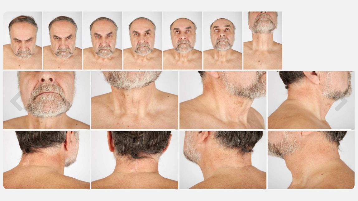 Alojz High Res Skin Texture Photo Set by N/A