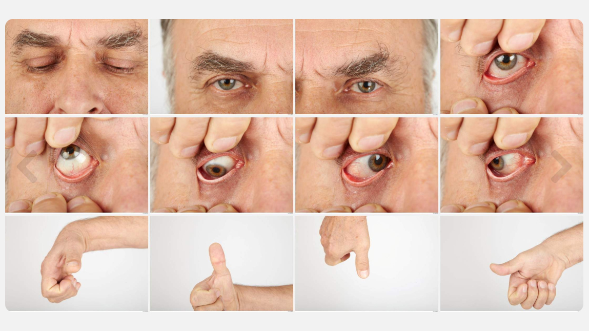 Alojz High Res Skin Texture Photo Set by N/A