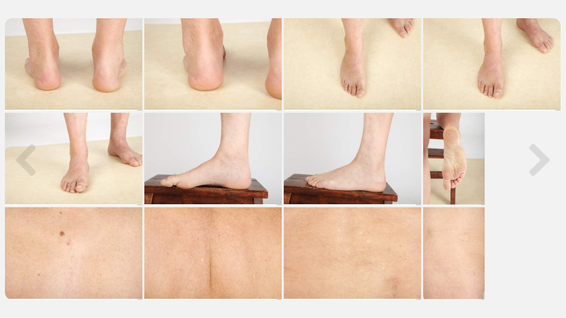Alojz High Res Skin Texture Photo Set by N/A