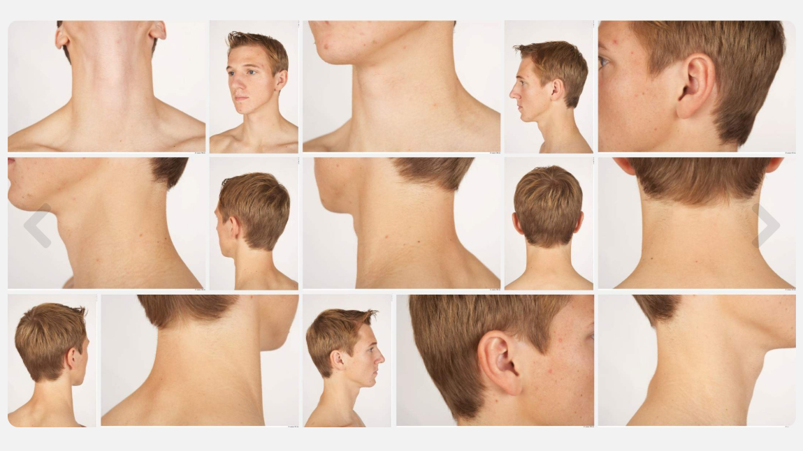 Alexander High Res Skin Texture Photo Set by N/A