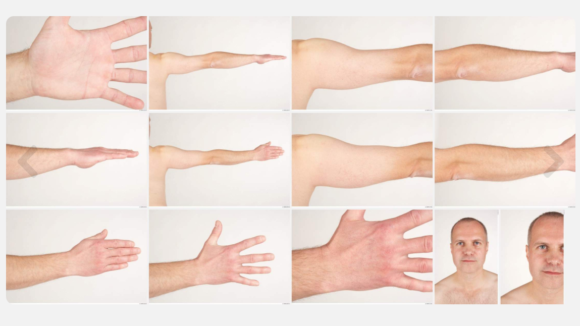 Albert High Res Skin Texture Photo Set by N/A