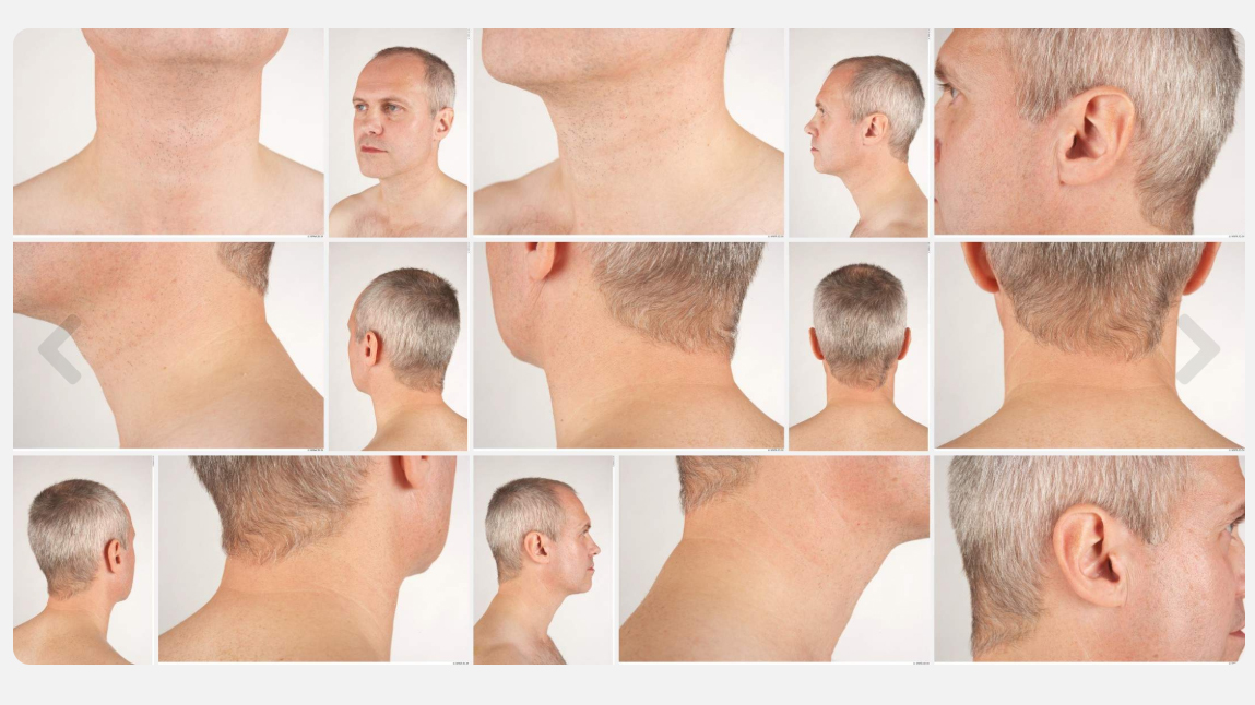Albert High Res Skin Texture Photo Set by N/A