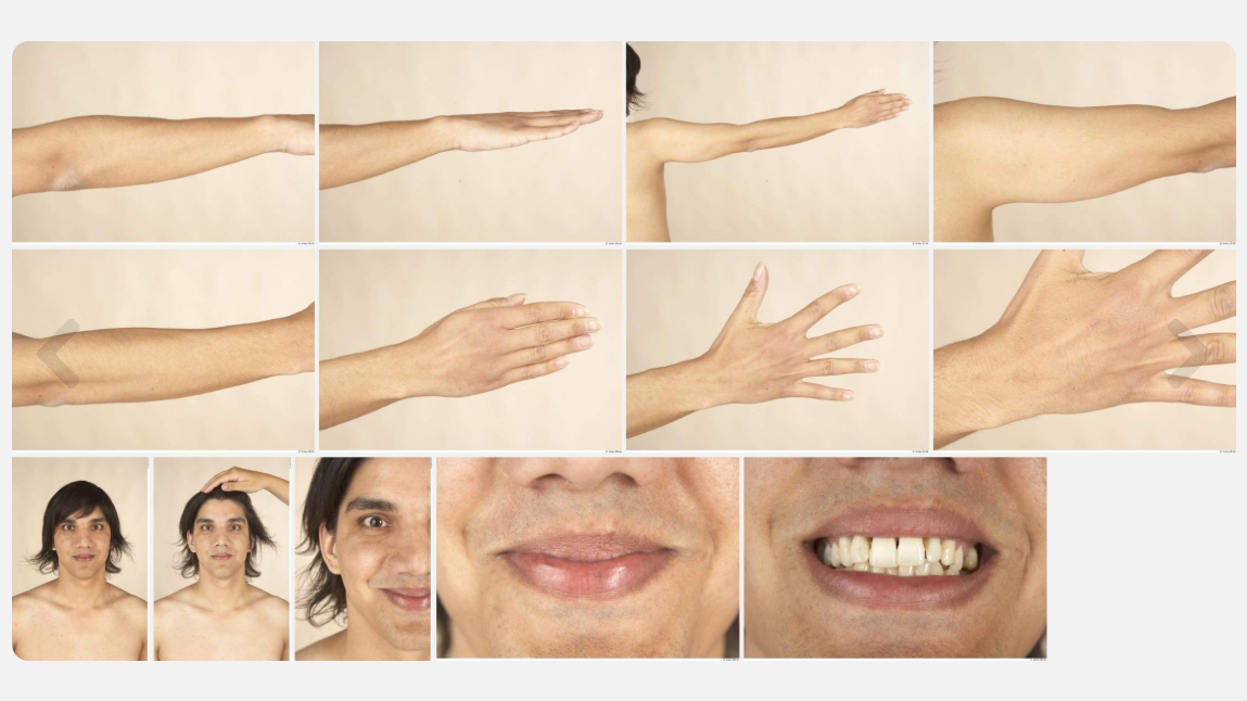 Adolf High Res Skin Texture Photo Set by N/A