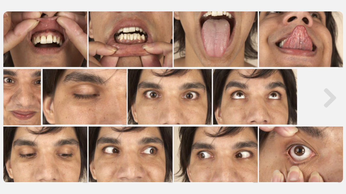 Adolf High Res Skin Texture Photo Set by N/A