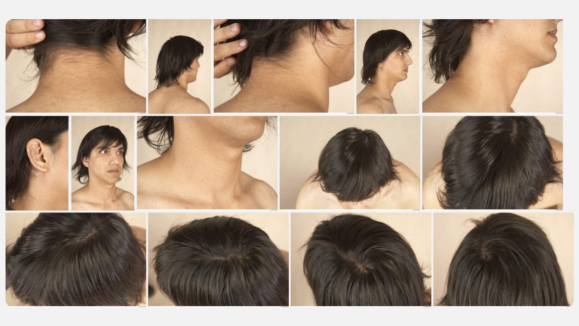Adolf High Res Skin Texture Photo Set by N/A