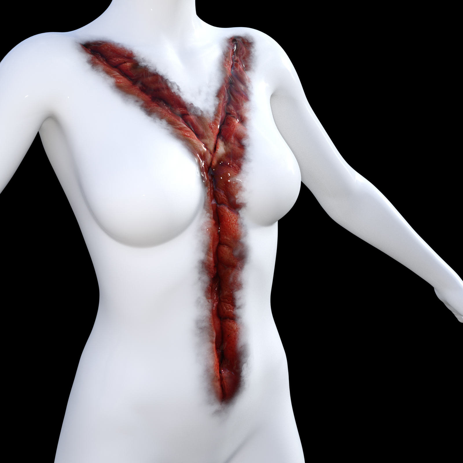 After Autopsy for G8F by N/A