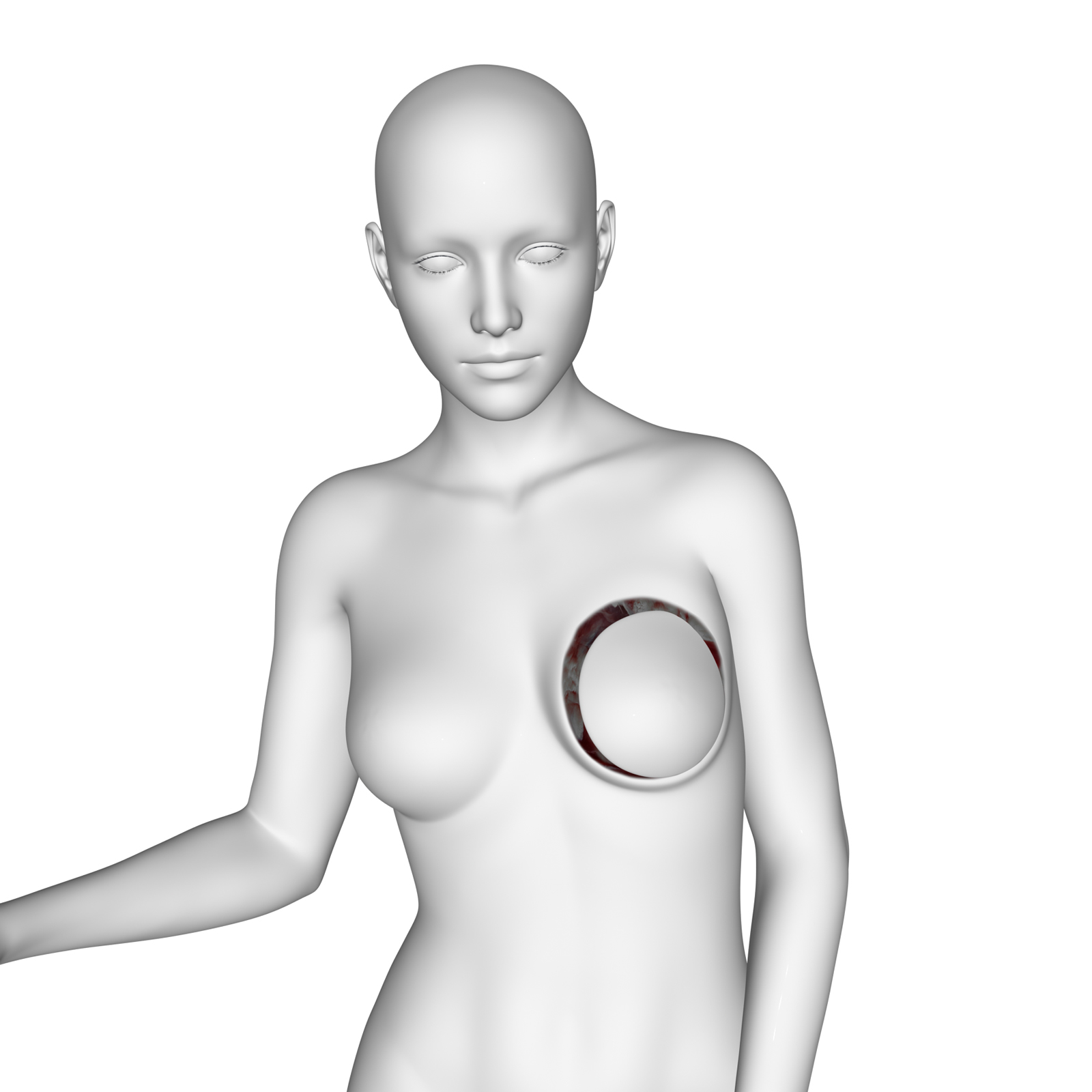Amazons Mastectomy for G8F and G8.1 F by N/A